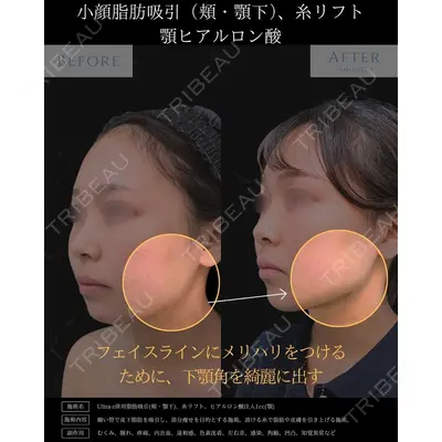 eクリニック 新宿院 相原 隆充医師の症例