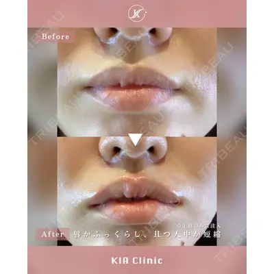 KIA CLINIC 心斎橋院 雲山　盛秀医師の症例