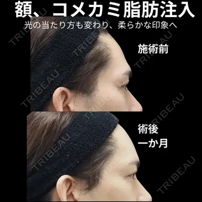下北沢スキンクリニック 保坂 宗孝医師の症例