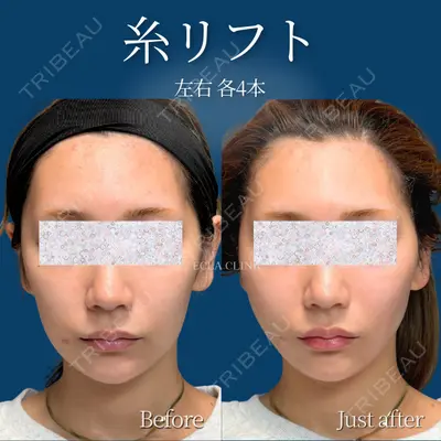 ECLA CLINIC (エクラクリニック) 緒方 善孝医師の症例