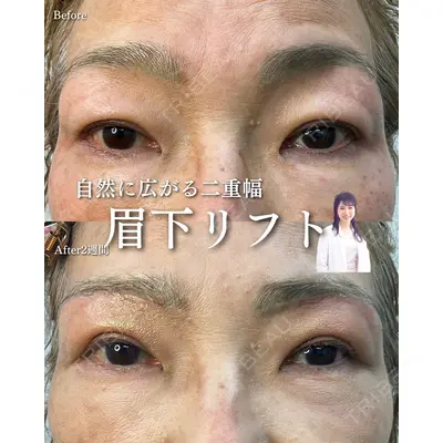 ルラ美容クリニック 渋谷本院 住友 沙織医師の症例