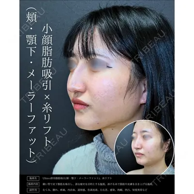 eクリニック 新宿院 相原 隆充医師の症例