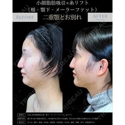 eクリニック 新宿院 相原 隆充医師の症例