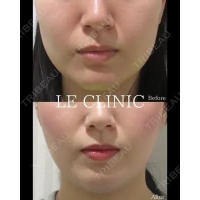 LE CLINICの症例