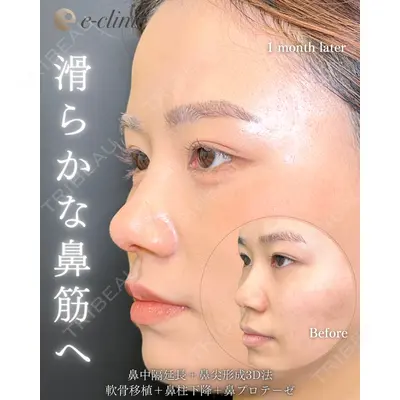 eクリニック 福岡院 伊藤 渉医師の症例