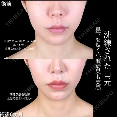 アリエル美容クリニック 大宮院 阪野 一世医師の症例