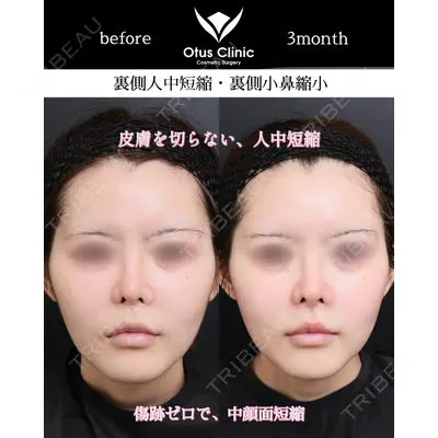 Otus Clinic 【オータスクリニック】 中 徳太郎医師の症例