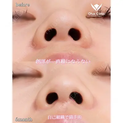 Otus Clinic 【オータスクリニック】 中 徳太郎医師の症例