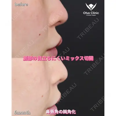 Otus Clinic 【オータスクリニック】 中 徳太郎医師の症例