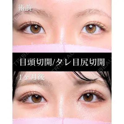 HAAB×DREAM BEAUTY CLINIC 大阪梅田院 鈴木 馨斗医師の症例