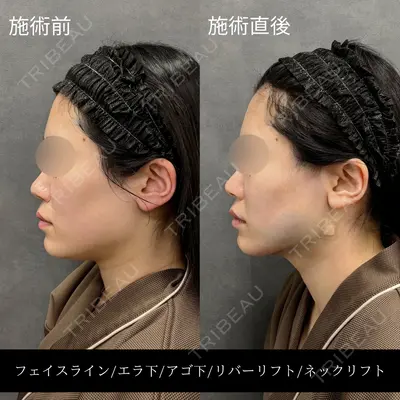 RIVER CLINIC（リバークリニック）大阪院の症例