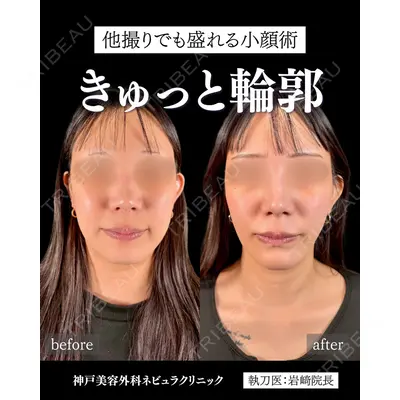 神戸美容外科 ネビュラクリニック 岩﨑 雅医師の症例
