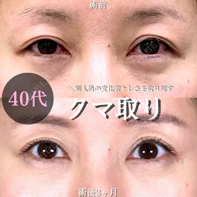 アリエル美容クリニック 大宮院 鈴木　桂介医師の症例