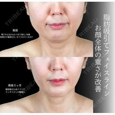 アリエル美容クリニック 横浜院 渡邉 光医師の症例