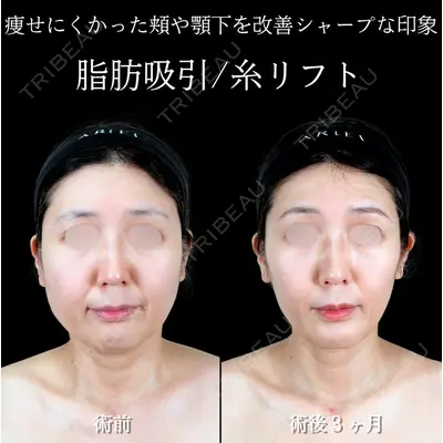 アリエル美容クリニック 横浜院 渡邉 光医師の症例