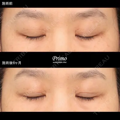 プリモ麻布十番クリニック 大場教弘医師の症例