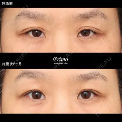 プリモ麻布十番クリニック 大場教弘医師の症例