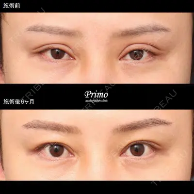 プリモ麻布十番クリニック 大場教弘医師の症例