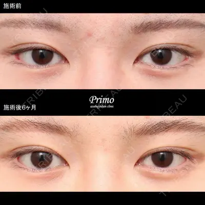 プリモ麻布十番クリニック 大場教弘医師の症例