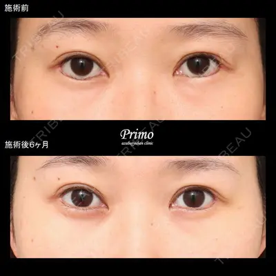 プリモ麻布十番クリニック 大場教弘医師の症例