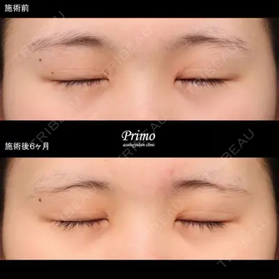 プリモ麻布十番クリニック 大場教弘医師の症例