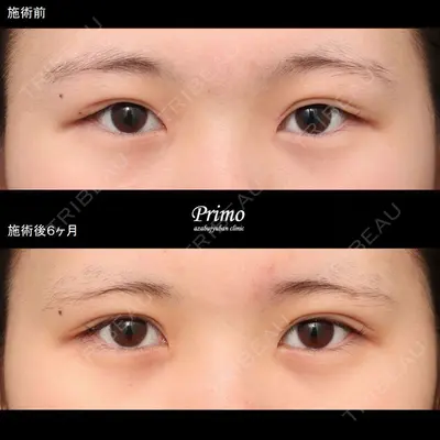 プリモ麻布十番クリニック 大場教弘医師の症例