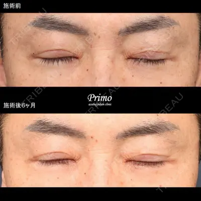 プリモ麻布十番クリニック 大場教弘医師の症例