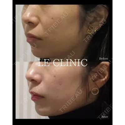 LE CLINICの症例