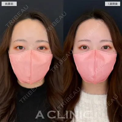 A CLINIC（エークリニック） 仙台院 伊藤 瑠桂医師の症例