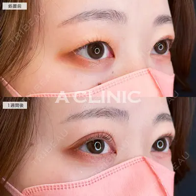 A CLINIC（エークリニック） 仙台院 伊藤 瑠桂医師の症例