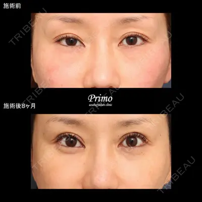 プリモ麻布十番クリニック 大場教弘医師の症例
