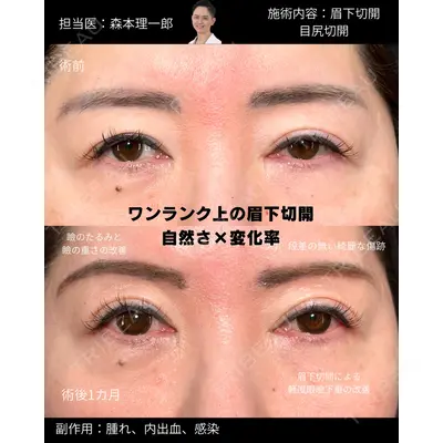 PRISM Beauty Clinic 町田院 森本 理一郎医師の症例