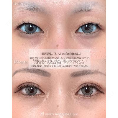 博多もへじのクリニック 村田 将光医師の症例