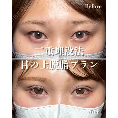 RÉ CLINIQUE SENDAI 田中 龍二医師の症例