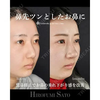 シンデレラ＆ダヴィンチクリニック 佐藤 博文医師の症例
