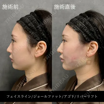 RIVER CLINIC（リバークリニック）大阪院の症例