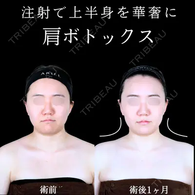 アリエル美容クリニック 水戸院 天白 典秀医師の症例