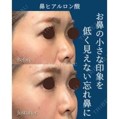 ECLA CLINIC (エクラクリニック)の症例