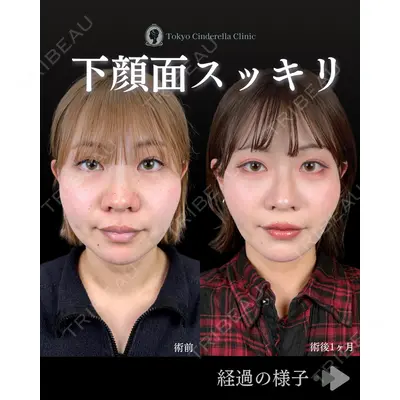 東京シンデレラ美容外科 池袋院 石井 達也医師の症例
