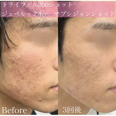 ルラ美容クリニック 渋谷本院 昼間 路子医師の症例
