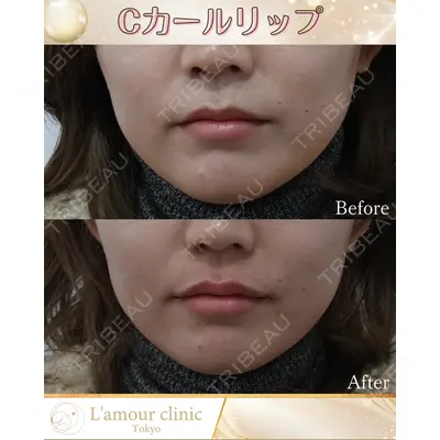 L‘amour clinic Tokyo【ラムールクリニック東京】の症例