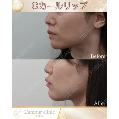 L‘amour clinic Tokyo【ラムールクリニック東京】の症例