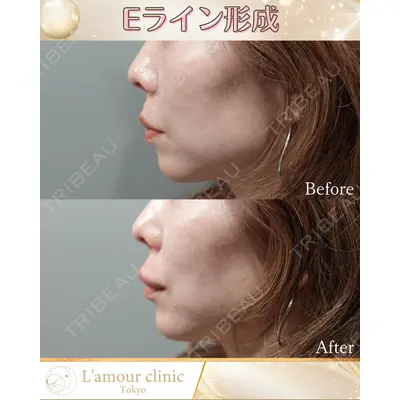 L‘amour clinic Tokyo【ラムールクリニック東京】の症例