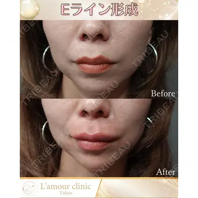 L‘amour clinic Tokyo【ラムールクリニック東京】の症例