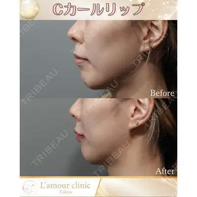 L‘amour clinic Tokyo【ラムールクリニック東京】の症例