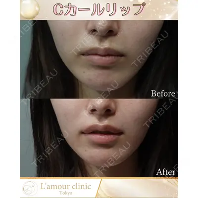 L‘amour clinic Tokyo【ラムールクリニック東京】の症例