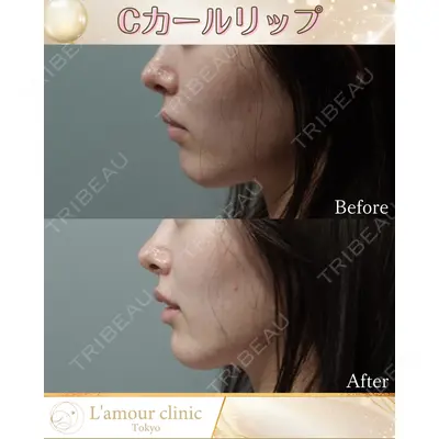 L‘amour clinic Tokyo【ラムールクリニック東京】の症例
