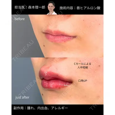 PRISM Beauty Clinic 町田院 森本 理一郎医師の症例