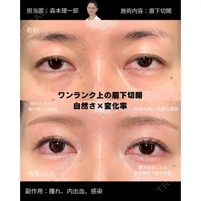 PRISM Beauty Clinic 新宿院の症例