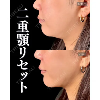 神戸美容外科 ネビュラクリニック 岩﨑 雅医師の症例